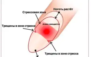 Почему трескается гель лак на ногтях: основные причины появления трещин