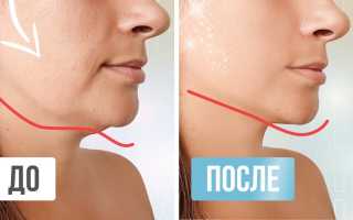 Как поднять щеки
