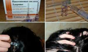 Как использовать никотиновую кислоту для роста волос?